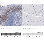 Anti-LAX1 Antibody
