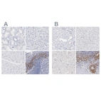 Immunohistochemical staining of human kidney, liver, skeletal muscle and tonsil using Anti-LAX1 antibody HPA002461 (A) shows similar protein distribution across tissues to independent antibody HPA003887 (B).