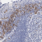 Immunohistochemical staining of human tonsil shows strong cytoplasmic positivity in a subset of non-germinal center cells.