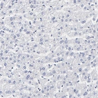 Immunohistochemical staining of human liver shows no positivity as expected.