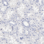 Immunohistochemical staining of human kidney shows no positivity as expected.