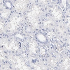 Immunohistochemical staining of human kidney shows no positivity as expected.