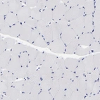 Immunohistochemical staining of human skeletal muscle shows no positivity as expected.