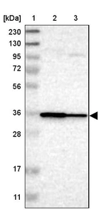 Lane 1: Marker [kDa] 230, 130, 95, 72, 56, 36, 28, 17, 11_br/_Lane 2: Human cell line RT-4_br/_Lane 3: Human cell line U-251MG sp