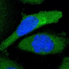 Immunofluorescent staining of human cell line A-431 shows localization to plasma membrane, cytosol & the Golgi apparatus.