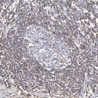 Immunohistochemical staining of human appendix shows high expression.
