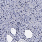 Anti-ANXA6 Antibody