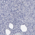 Immunohistochemical staining of human pancreas shows low expression as expected.