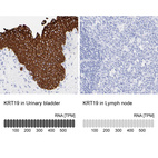 Anti-KRT19 Antibody