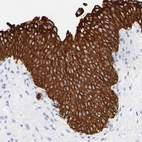 Immunohistochemical staining of human urinary bladder shows strong cytoplasmic/membranous positivity in urothelial cells.
