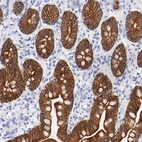 Immunohistochemical staining of human small intestine shows moderate cytoplasmic/membranous positivity in glandular cells.