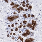 Immunohistochemical staining of human breast shows moderate cytoplasmic/membranous positivity in glandular cells.