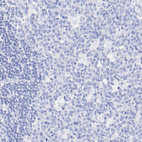 Anti-KRT19 Antibody