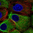 Immunofluorescent staining of human cell line MCF7 shows localization to intermediate filaments.