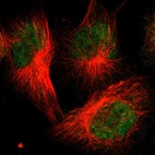 Anti-FBXO3 Antibody