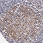 Anti-GCSAM Antibody