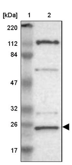 Lane 1: Marker [kDa] 220, 112, 84, 47, 32, 26, 17_br/_Lane 2: Human cell line RT-4