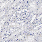 Anti-RPH3A Antibody