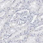 Immunohistochemical staining of human kidney shows no positivity in cells in tubules as expected.