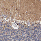 Anti-RPH3A Antibody