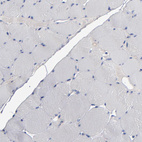 Immunohistochemical staining of human skeletal muscle shows no positivity in myocytes as expected.
