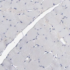 Immunohistochemical staining of human skeletal muscle shows no positivity in myocytes as expected.
