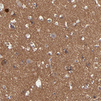 Anti-RPH3A Antibody