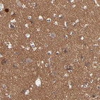Immunohistochemical staining of human cerebral cortex shows strong positivity in neuropil.