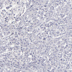 Anti-ABCC4 Antibody