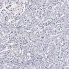 Immunohistochemical staining of human pancreas shows no positivity in exocrine glandular cells as expected.