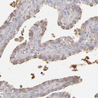 Anti-ABCC4 Antibody