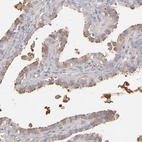Immunohistochemical staining of human fallopian tube shows strong membranous positivity in glandular cells.