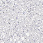 Immunohistochemical staining of human liver shows no positivity in hepatocytes as expected.
