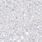 Anti-ABCC4 Antibody