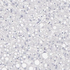 Immunohistochemical staining of human liver shows no positivity in hepatocytes as expected.