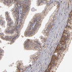 Anti-ABCC4 Antibody