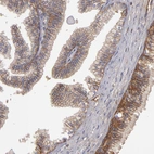 Immunohistochemical staining of human prostate shows strong membranous positivity in glandular cells.