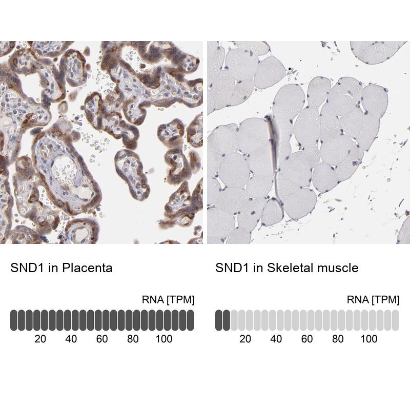 Anti-SND1 Antibody