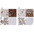 Immunohistochemical staining of human cerebral cortex, pancreas, placenta and skeletal muscle using Anti-SND1 antibody HPA002529 (A) shows similar protein distribution across tissues to independent antibody HPA002632 (B).