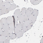 Immunohistochemical staining of human skeletal muscle shows low expression as expected.
