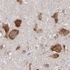 Immunohistochemical staining of human cerebral cortex using Anti-SND1 antibody HPA002529.