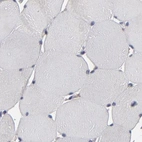 Immunohistochemical staining of human skeletal muscle using Anti-SND1 antibody HPA002529.