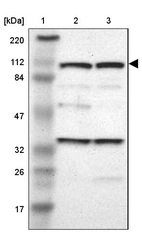 Lane 1: Marker [kDa] 220, 112, 84, 47, 32, 26, 17_br/_Lane 2: Human cell line RT-4_br/_Lane 3: Human cell line U-251MG sp