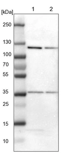 Lane 1: NIH-3T3 cell lysate (Mouse embryonic fibroblast cells)_br/_Lane 2: NBT-II cell lysate (Rat Wistar bladder tumour cells)