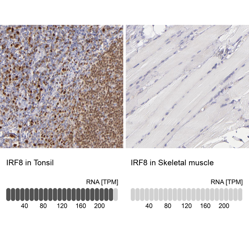 Anti-IRF8 Antibody