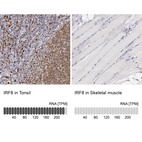 Anti-IRF8 Antibody