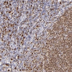Immunohistochemical staining of human tonsil shows strong nuclear positivity in germinal and non-germinal center cells.