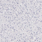Immunohistochemical staining of human liver shows no positivity in hepatocytes as expected.