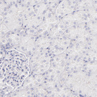 Anti-IRF8 Antibody