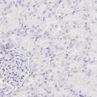 Immunohistochemical staining of human kidney shows no positivity in cells in tubules as expected.